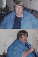 Bob - before