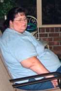 Kathleen - before